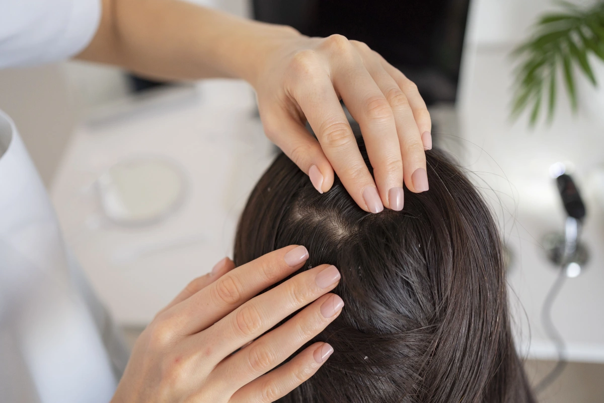 Dandruff Treatments That Work