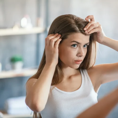 <strong>Scalp Psoriasis: What Is It and How To Treat It?</strong>