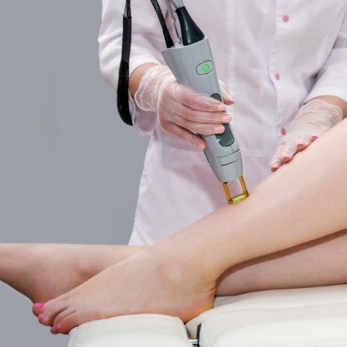 We Answer Every Question You’ve Ever Had About Laser Hair Removal